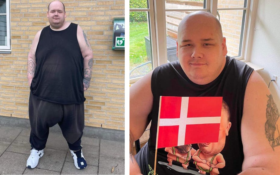 35-årige Stefan Jepsen fra TV2-dokumentaren "Stor Mand" har i dag smidt 175 kilo af de 350 kilo. Nu har han fået svar på hospitalet, som har godkendt ham til en helt særlig operation.