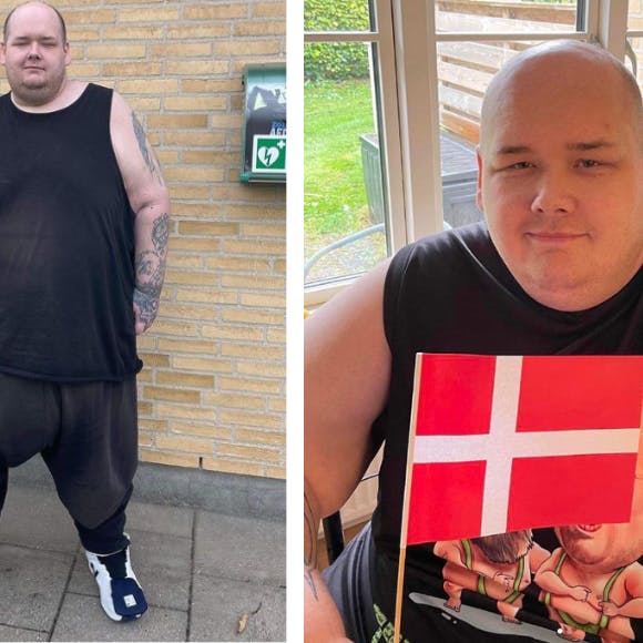 35-årige Stefan Jepsen fra TV2-dokumentaren "Stor Mand" har i dag smidt 175 kilo af de 350 kilo. Nu har han fået svar på hospitalet, som har godkendt ham til en helt særlig operation.