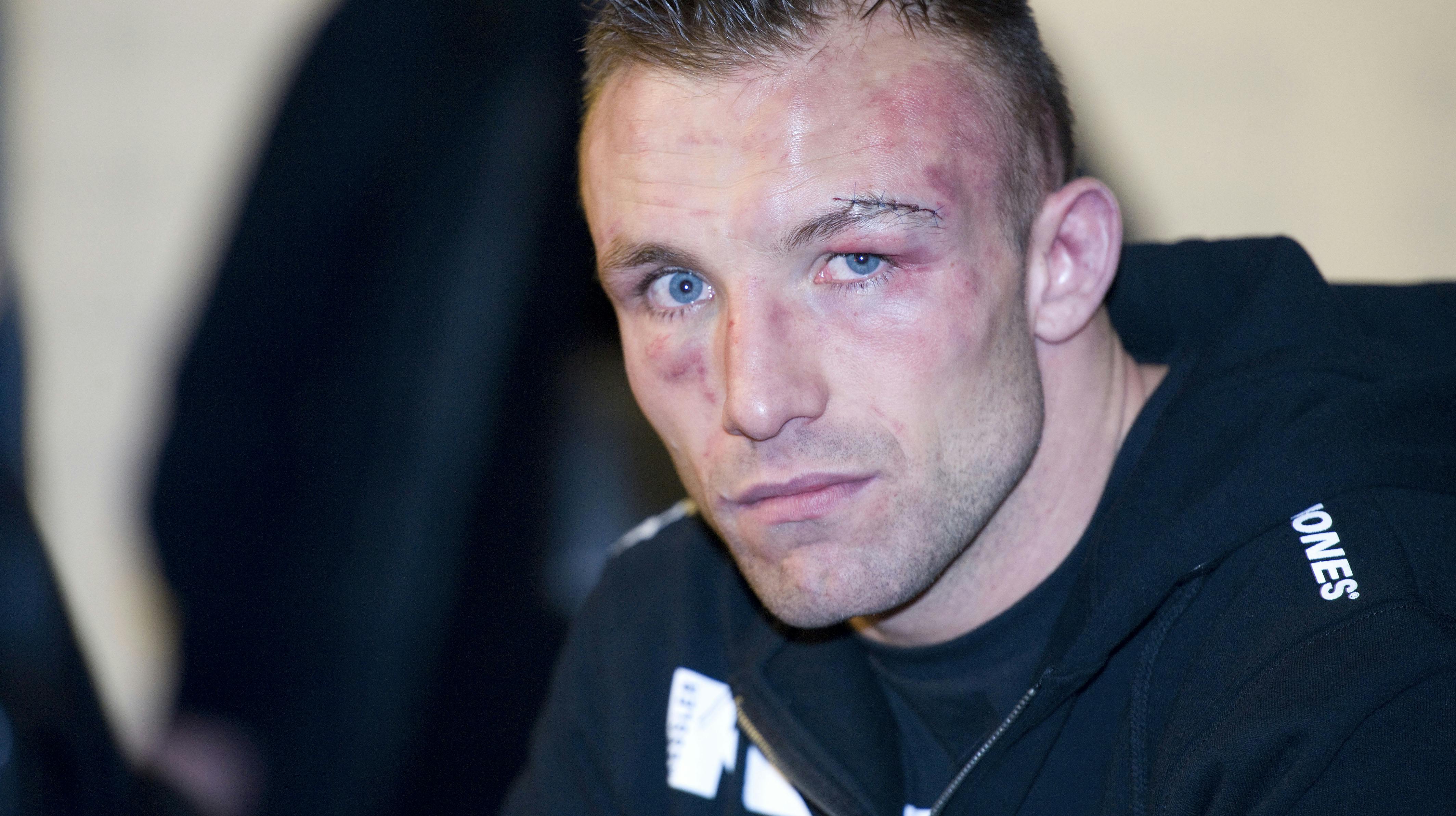 Mikkel Kessler forslået