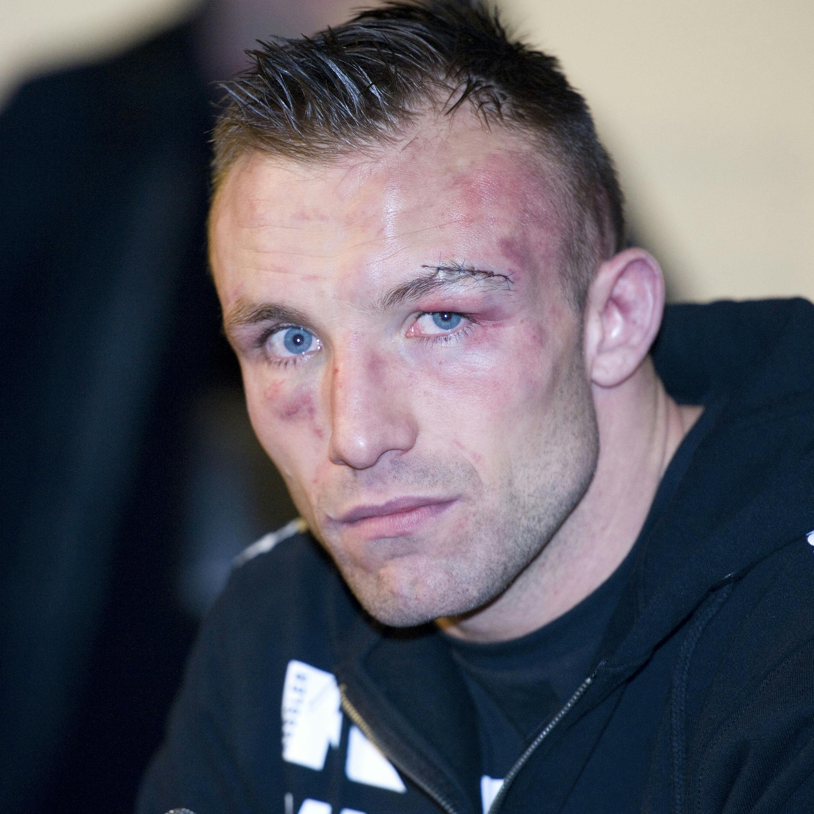 Mikkel Kessler forslået