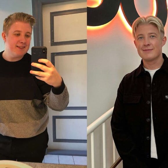 Billedet til venstre er fra April 2021 en måned efter, Stefan begyndte sit vægttab. Billedet til højre er fra 19. oktober 2024.
