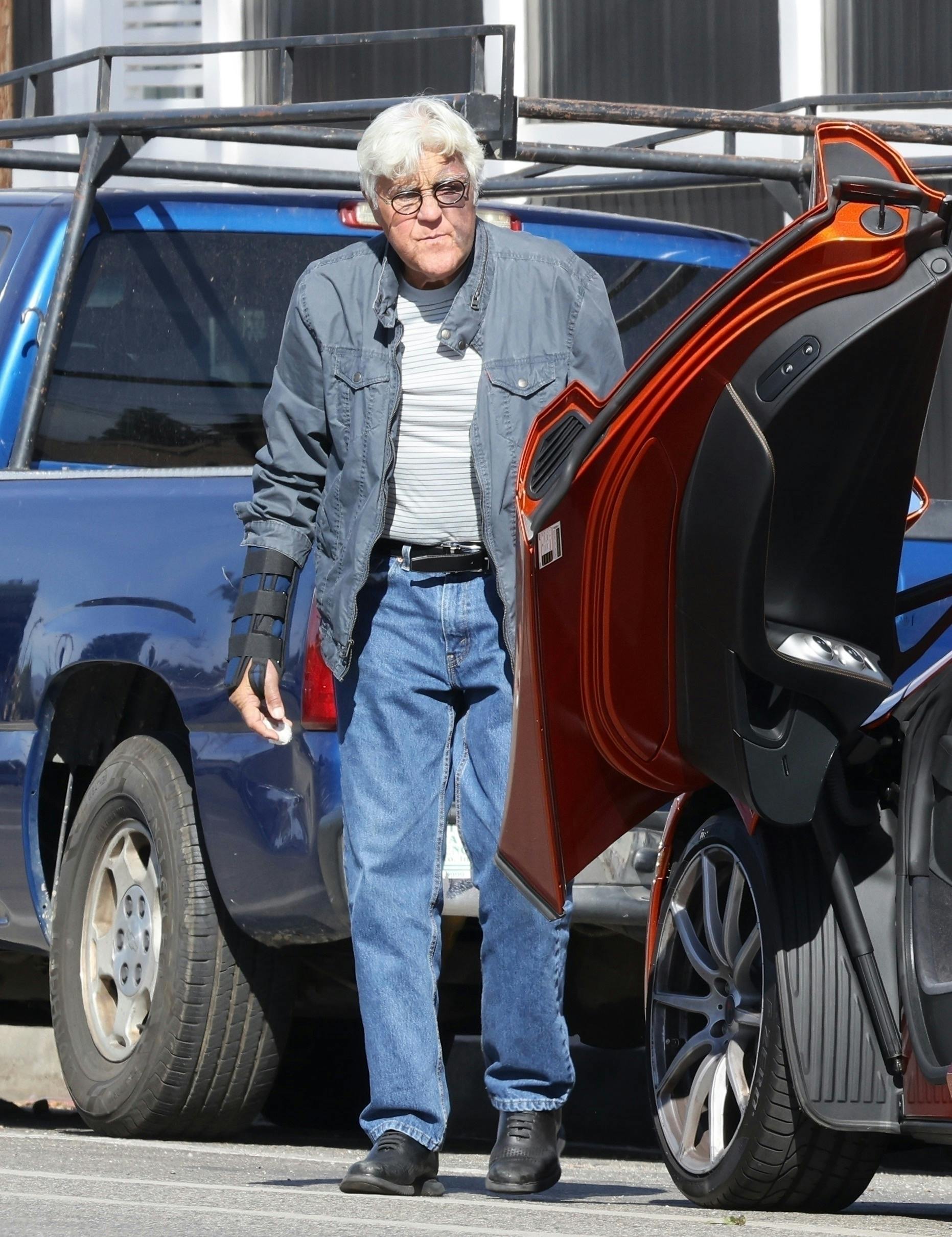 Jay Leno spottet i Los Angeles med armen i gips og et voldsomt medtaget ansigt.