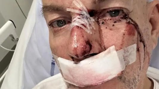 Kenny Jensen vågnede op til et skræmmende syn på hospitalet. SE og HØR har fået tilladelse til at bringe billedet. 