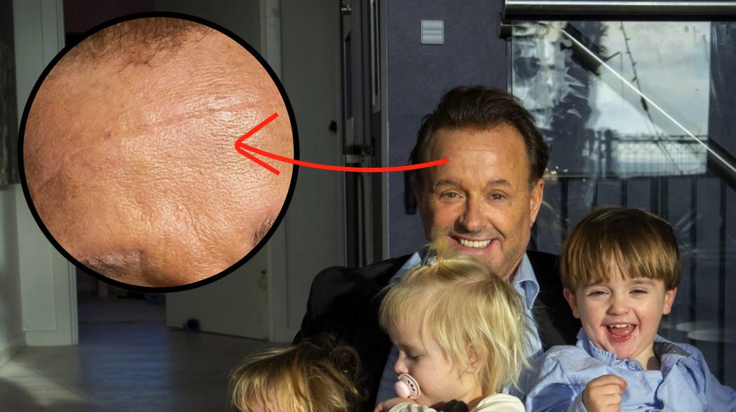 Arret er stadig meget tydeligt.