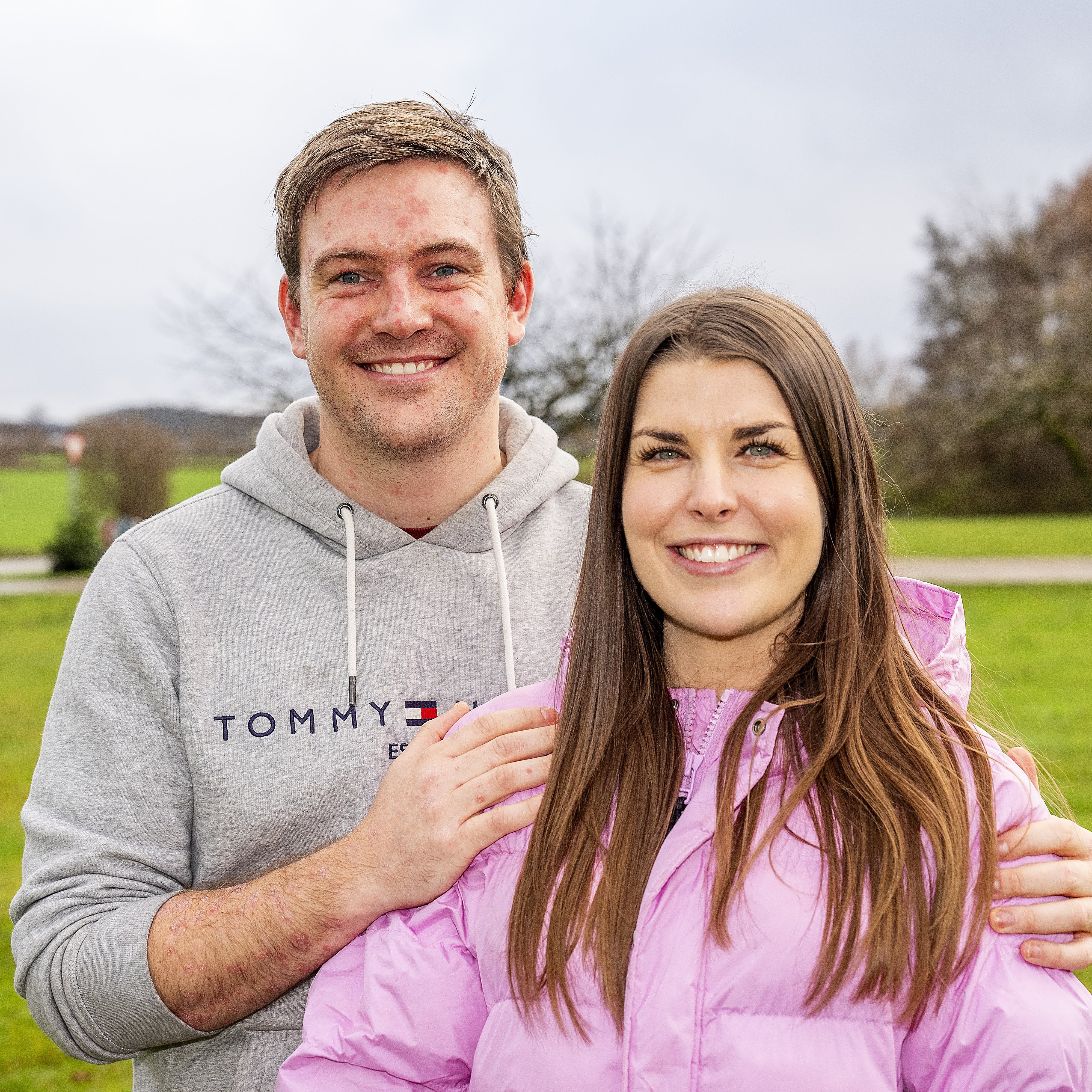 Anders og Emilie fra ”Kærlighed hvor kragerne vender” afslører nu kønnet på deres guldklump på Instagram.