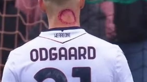 Jens Odgaard har nu forklaret årsagen til det opsigtsvækkende "bid".