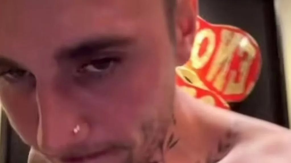 Fans er bekymret for Justin Bieber, der da også ser noget ramt ud i ny video.