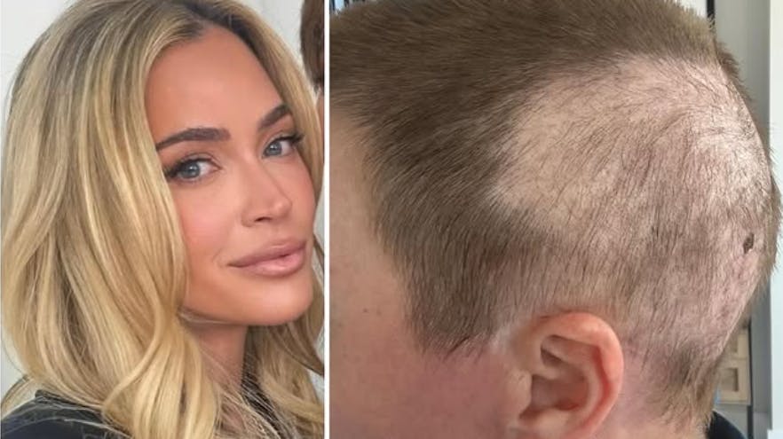 Den amerikanske realitykendis Teddi Mellencamp har fået en frygtelig besked fra lægerne og er med egne ord ”rigtig bange for første gang”