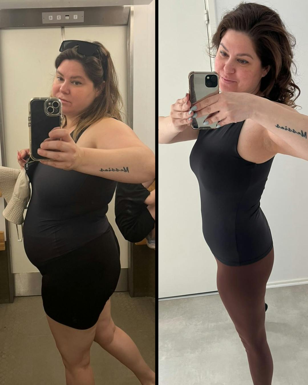 Her kan man tydeligt se forskellen fra før og efter Stina Petersen startede på Wegovy.