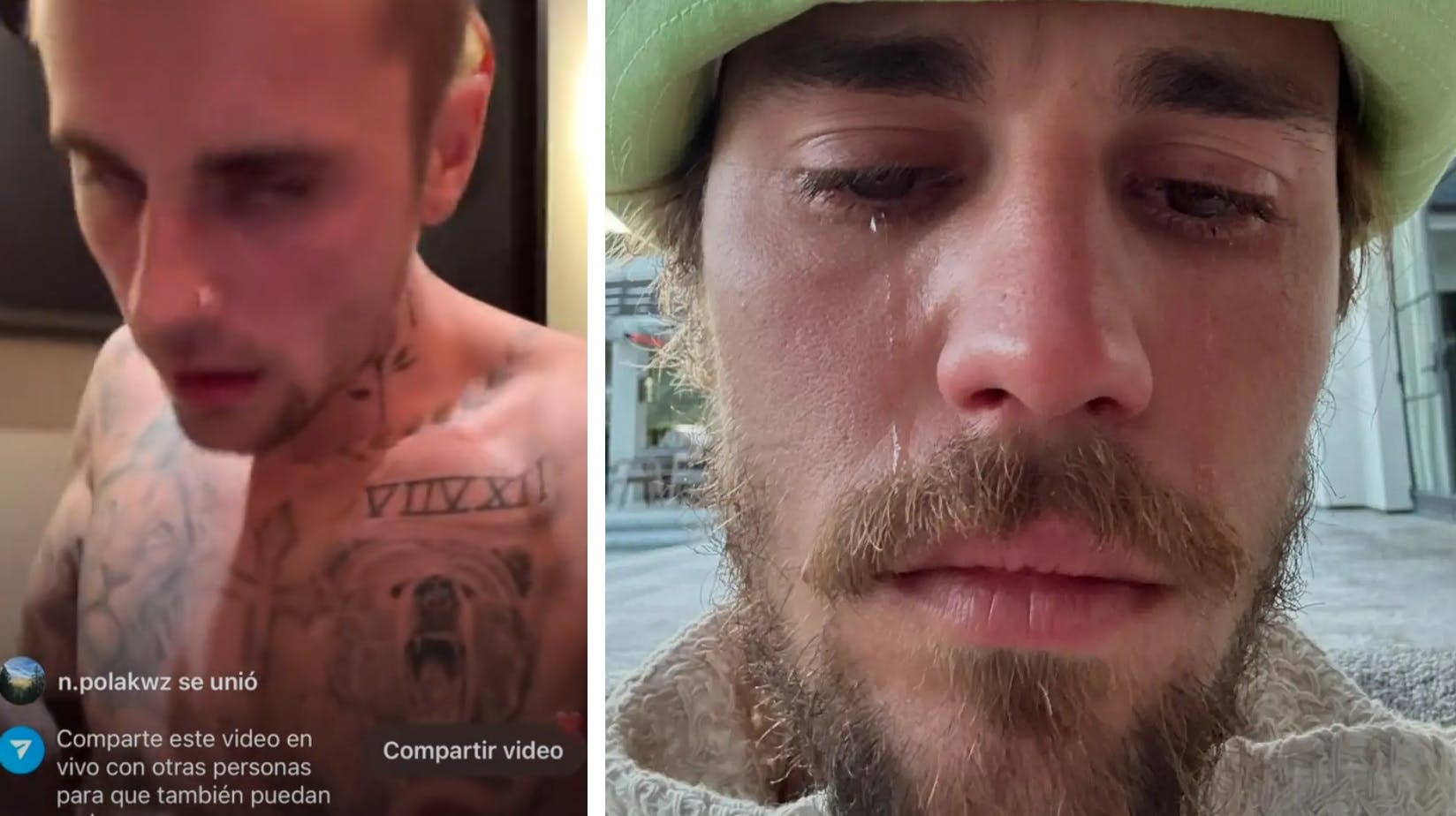 Justin Biebers gode ven melder sig nu i koret af folk, der er bekymrede for popstjernen.