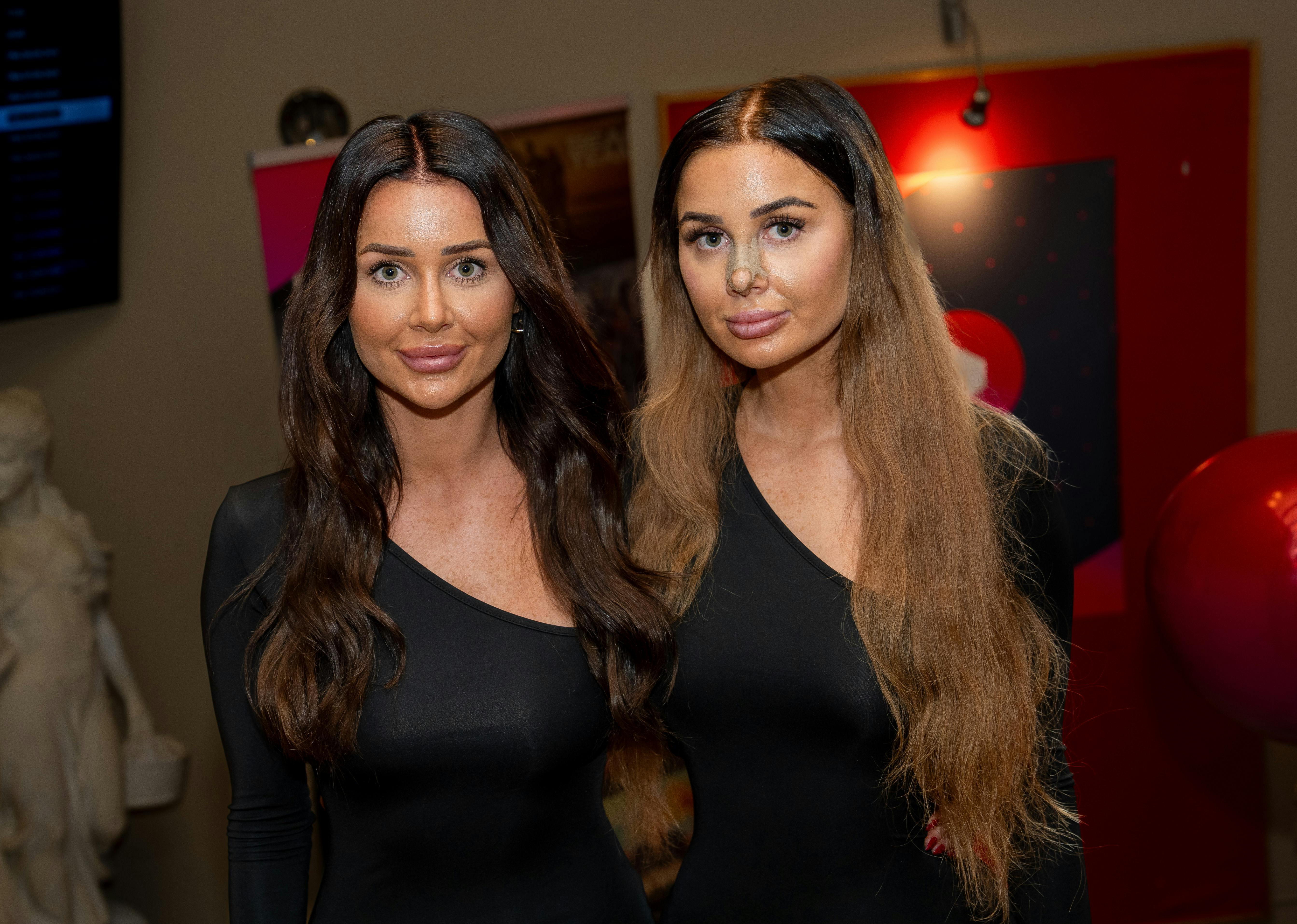 Isabell og Vivi Bach til pressemøde hos Viaplay, da sidstnævnte netop havde fået opereret næsen.