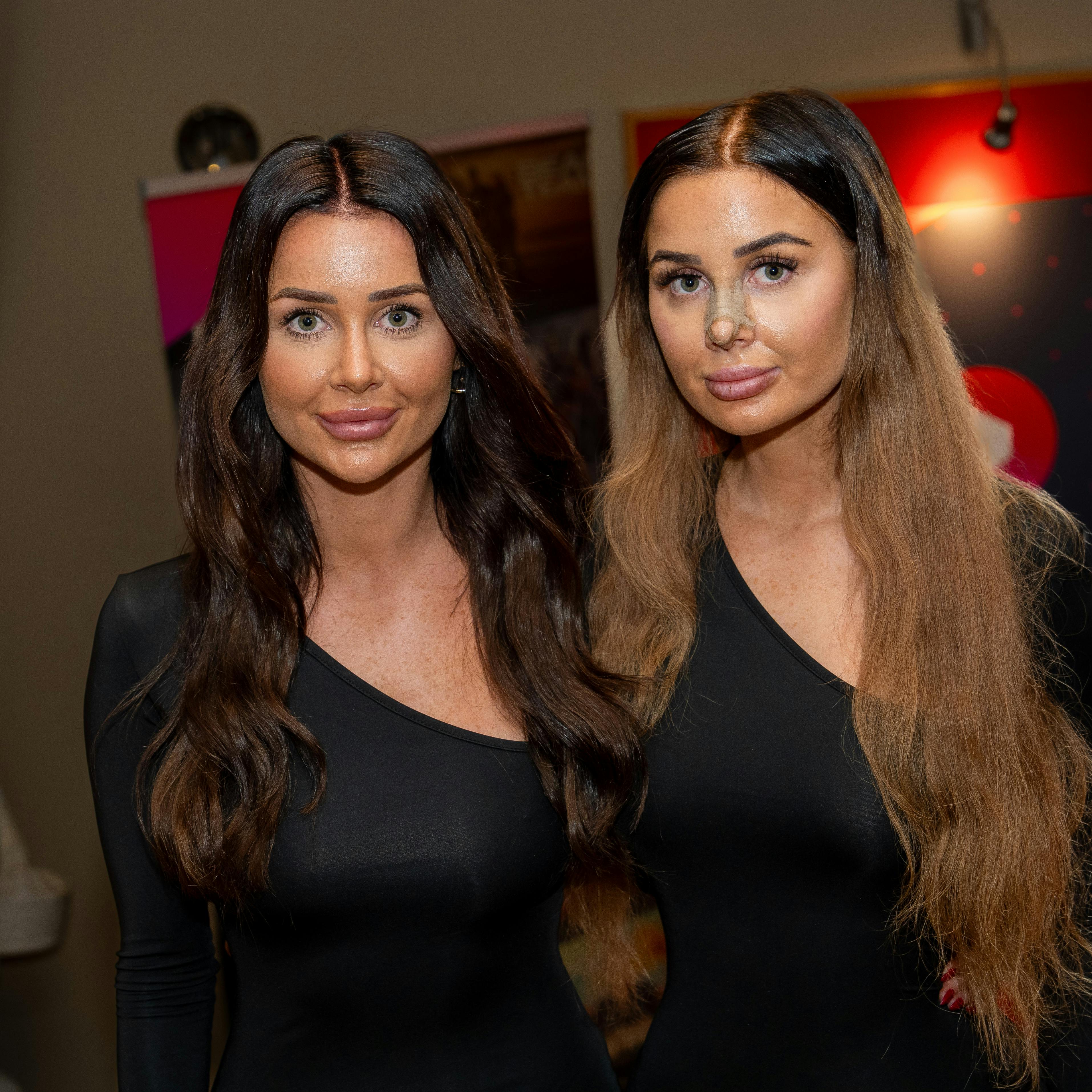 Isabell og Vivi Bach til pressemøde hos Viaplay, da sidstnævnte netop havde fået opereret næsen.