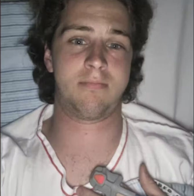 Rasmus Ove fortæller, at man normalt godt kan se hans kindben og hans adamsæble.