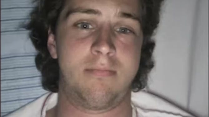 Rasmus Ove fortæller, at man normalt godt kan se hans kindben og hans adamsæble.
