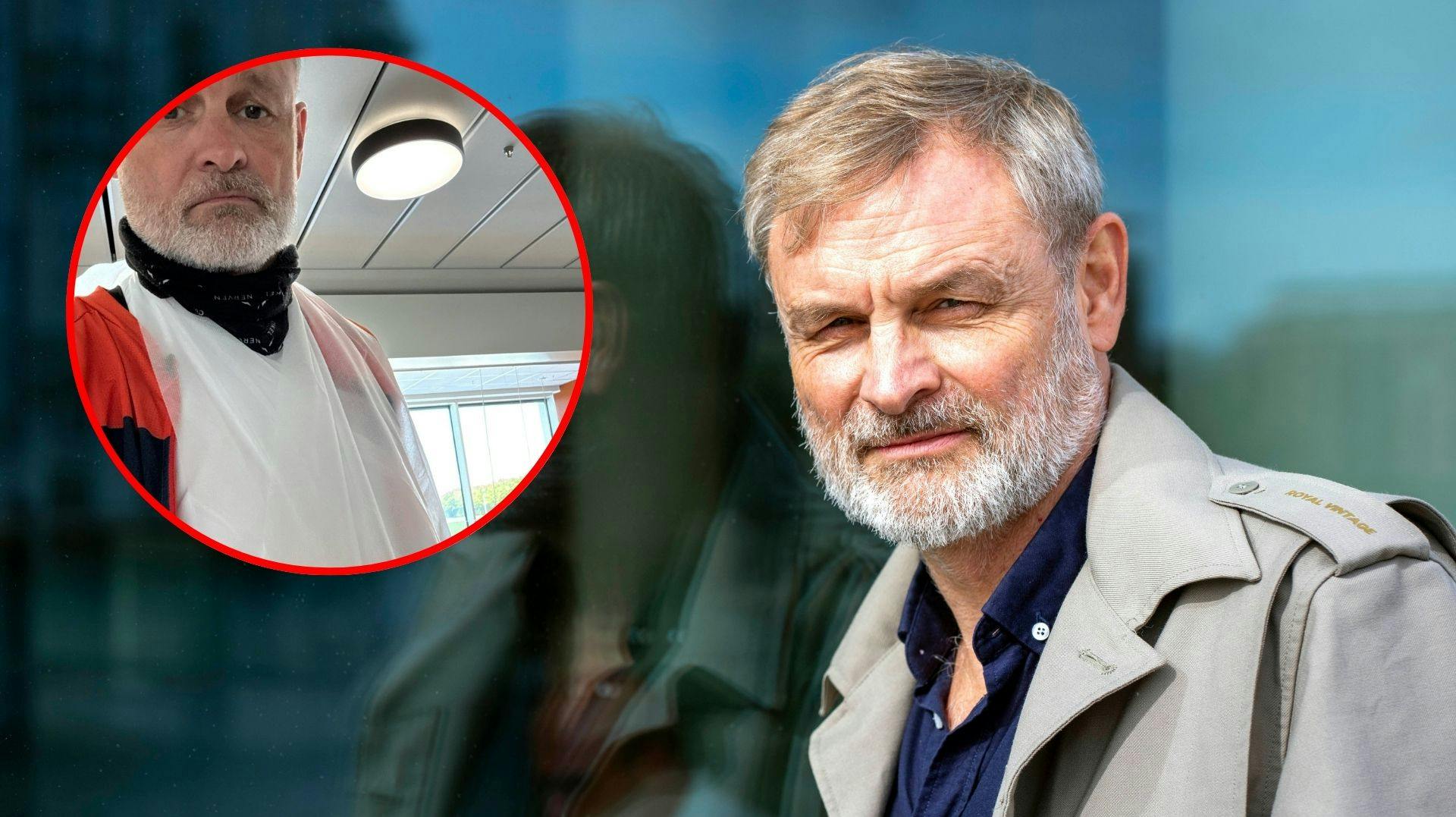 Et brækket kraveben, to brækkede ribben og en flænge i skulderbladet. Det er dommen, efter et cykelstyrt for Claus Elming, som misser Scleroseforeningens cykelprojekt, Cykelnerven, hvor der samles penge ind til foreningen.