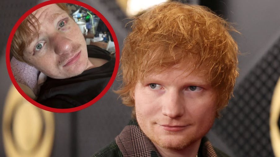 Ed Sheeran-lookaliken Ty Jones blev tæsket på festival af folk, der troede, han var den britiske sanger.
