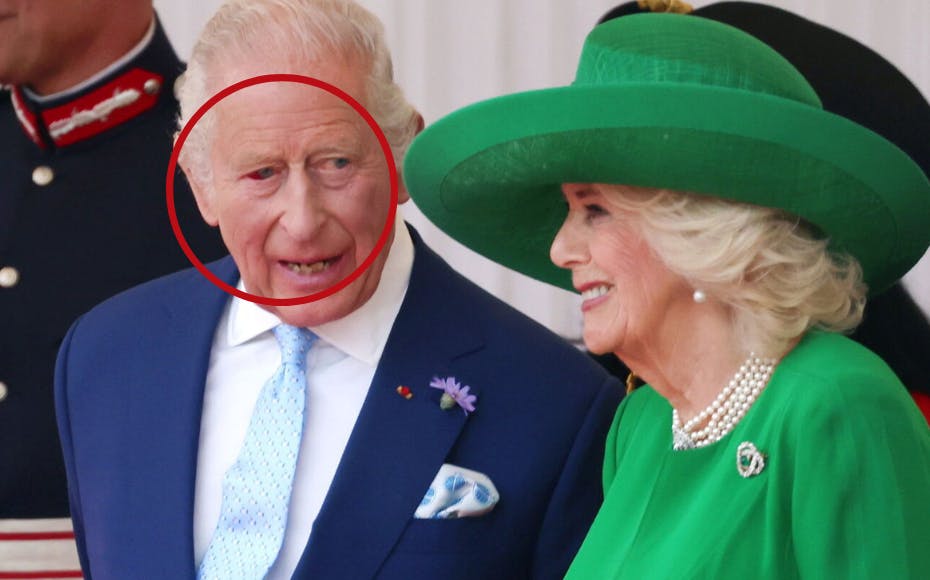 Kong Charles ene øje er helt rødt – men der er ingen grund til panik, oplyser det britiske kongehus