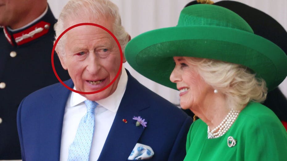 Kong Charles ene øje er helt rødt – men der er ingen grund til panik, oplyser det britiske kongehus