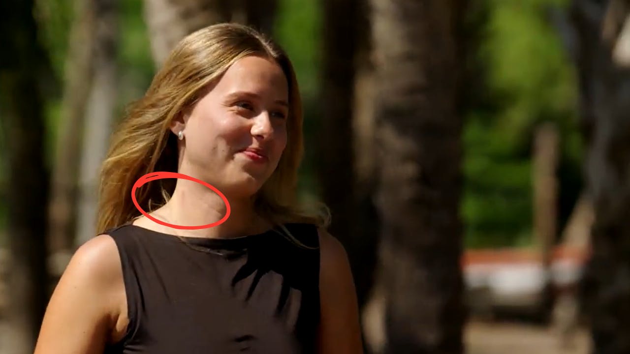 Emma dukkede op med sugemærker på sin date med Anton i "Bachelorette". Få timer inden havde hun forladt den seng, hun delte med Victor Emil.