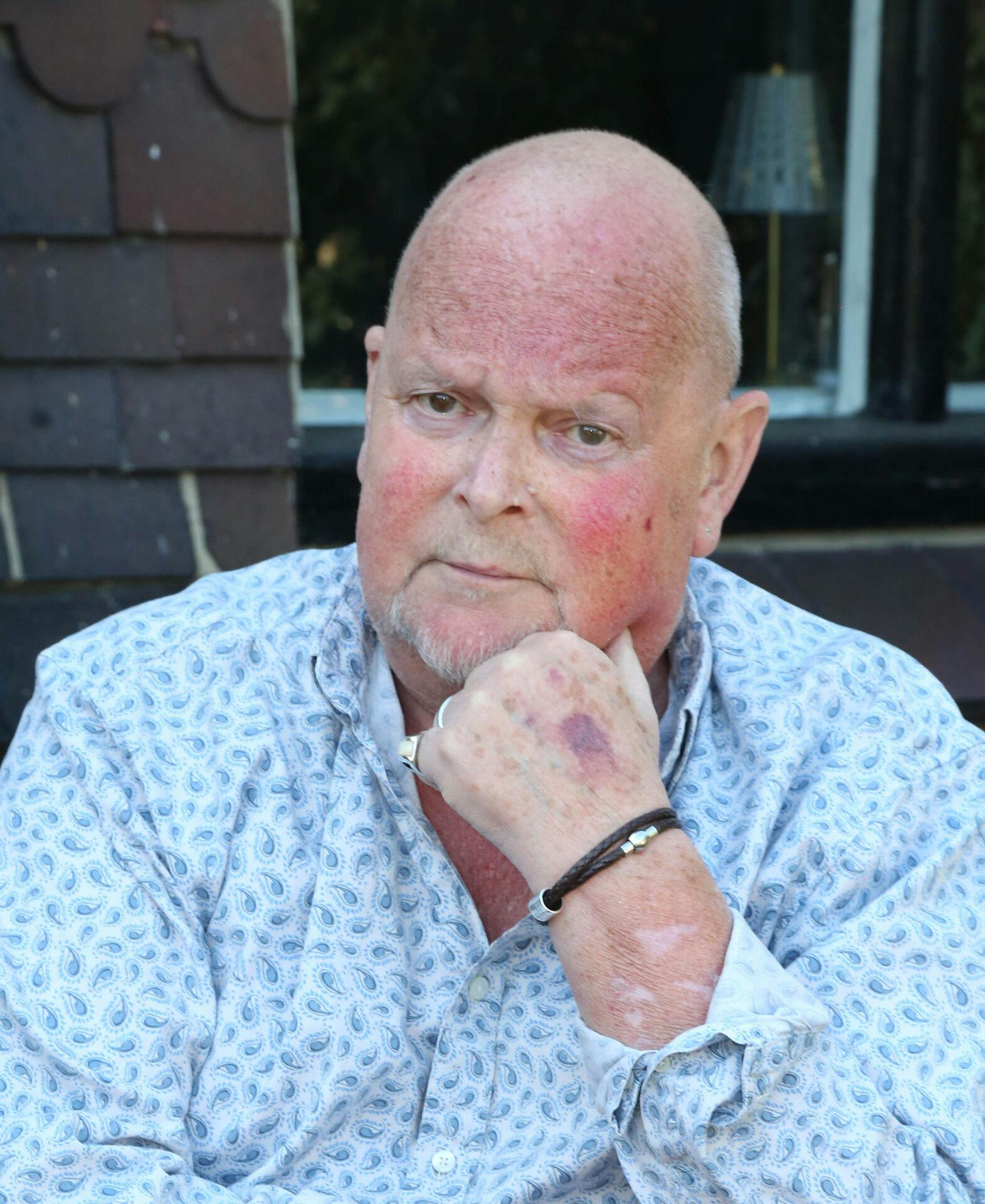 James Whale har ifølge sig selv ikke lang tid igen.
