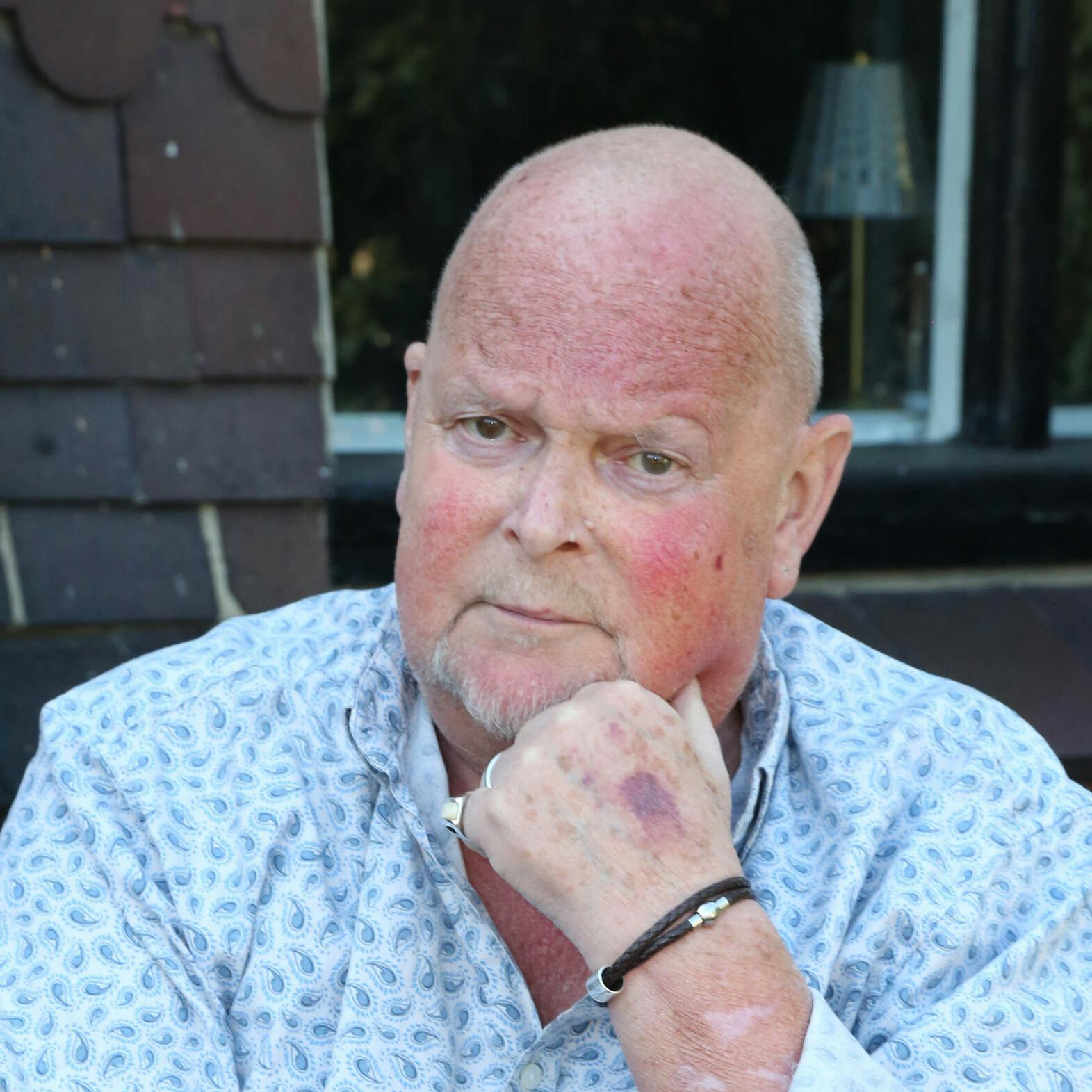 James Whale har ifølge sig selv ikke lang tid igen.