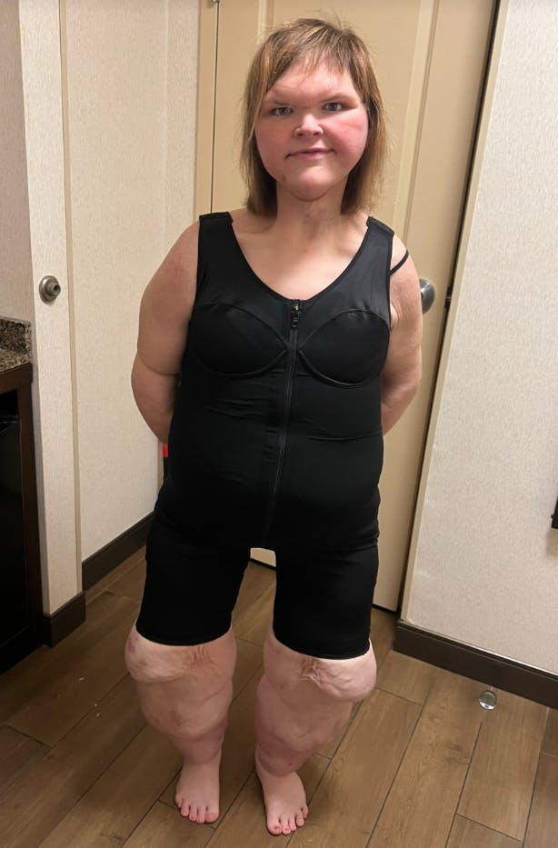 Der er blevet meget mindre af Tammy Slaton efter imponerende 225 kilo er røget.