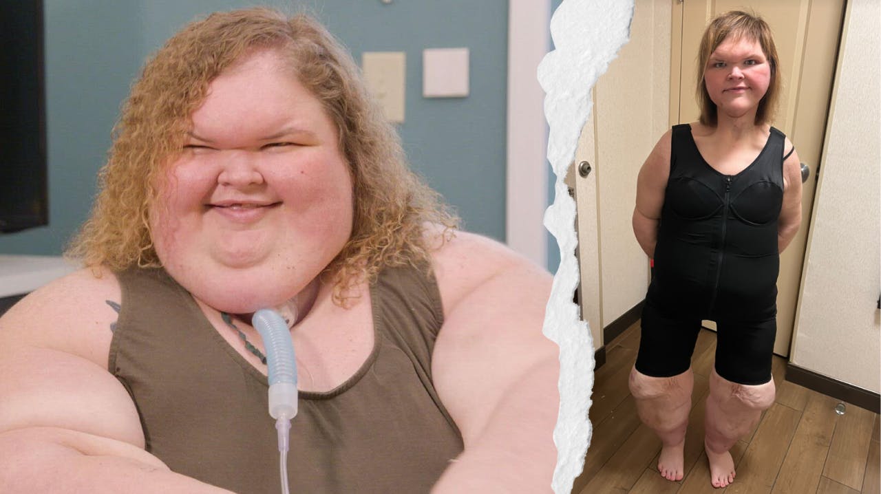 Tammy Slaton vejede over 340 kilo, da hun blev kendt i TLC-programmet "1000 lb. Sisters". Nu har hun fået fjernet seks kilo hud og tabt i alt 225.