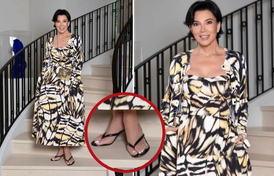 Kris Jenner havde pludselig en ekstra tå på den ene fod.