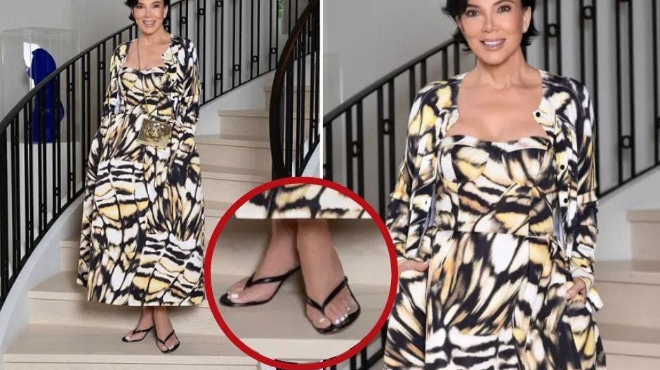 Kris Jenner havde pludselig en ekstra tå på den ene fod.