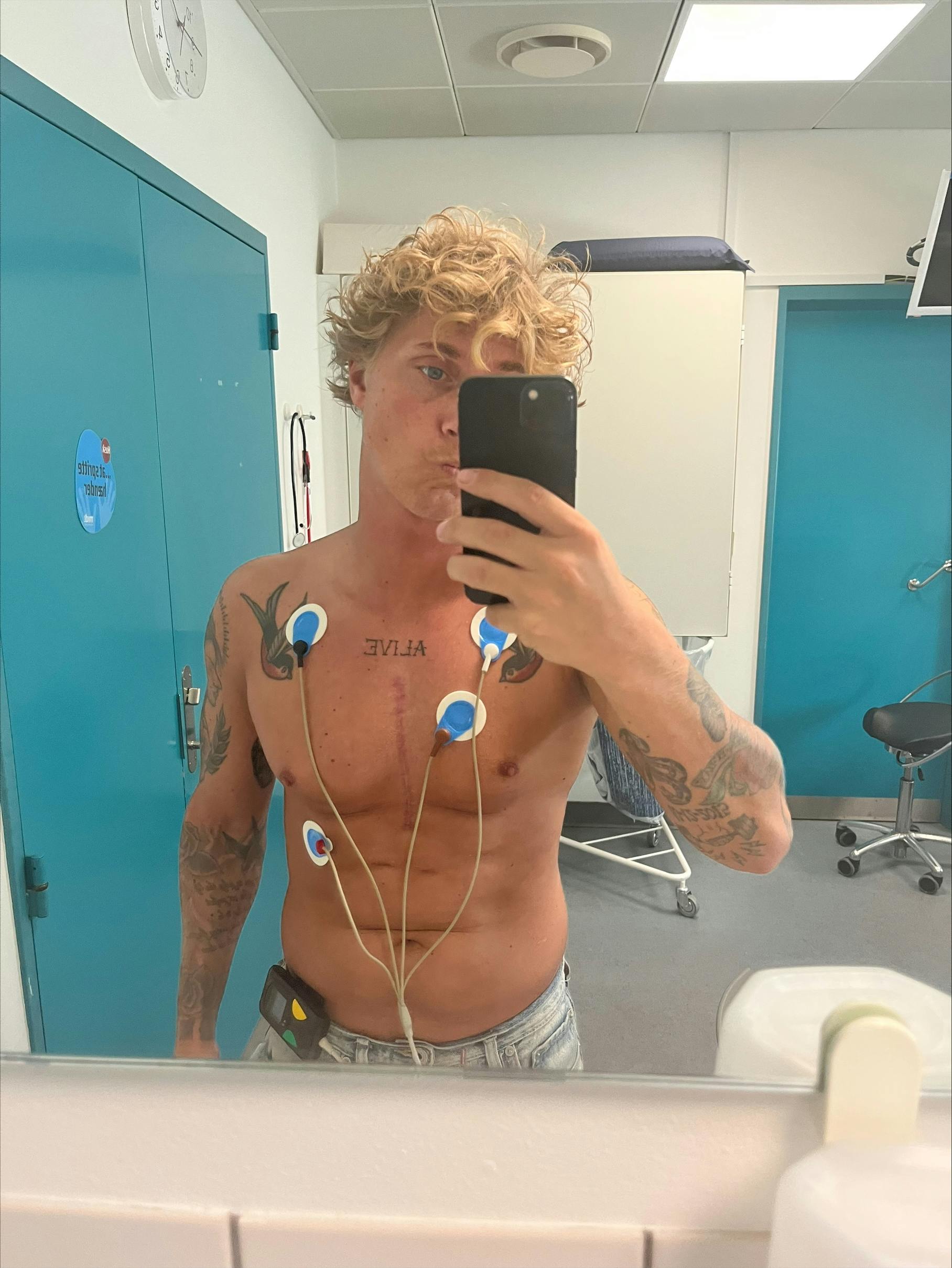 Nikolaj Rosé skal bære elektroder på kroppen de næste syv dage.