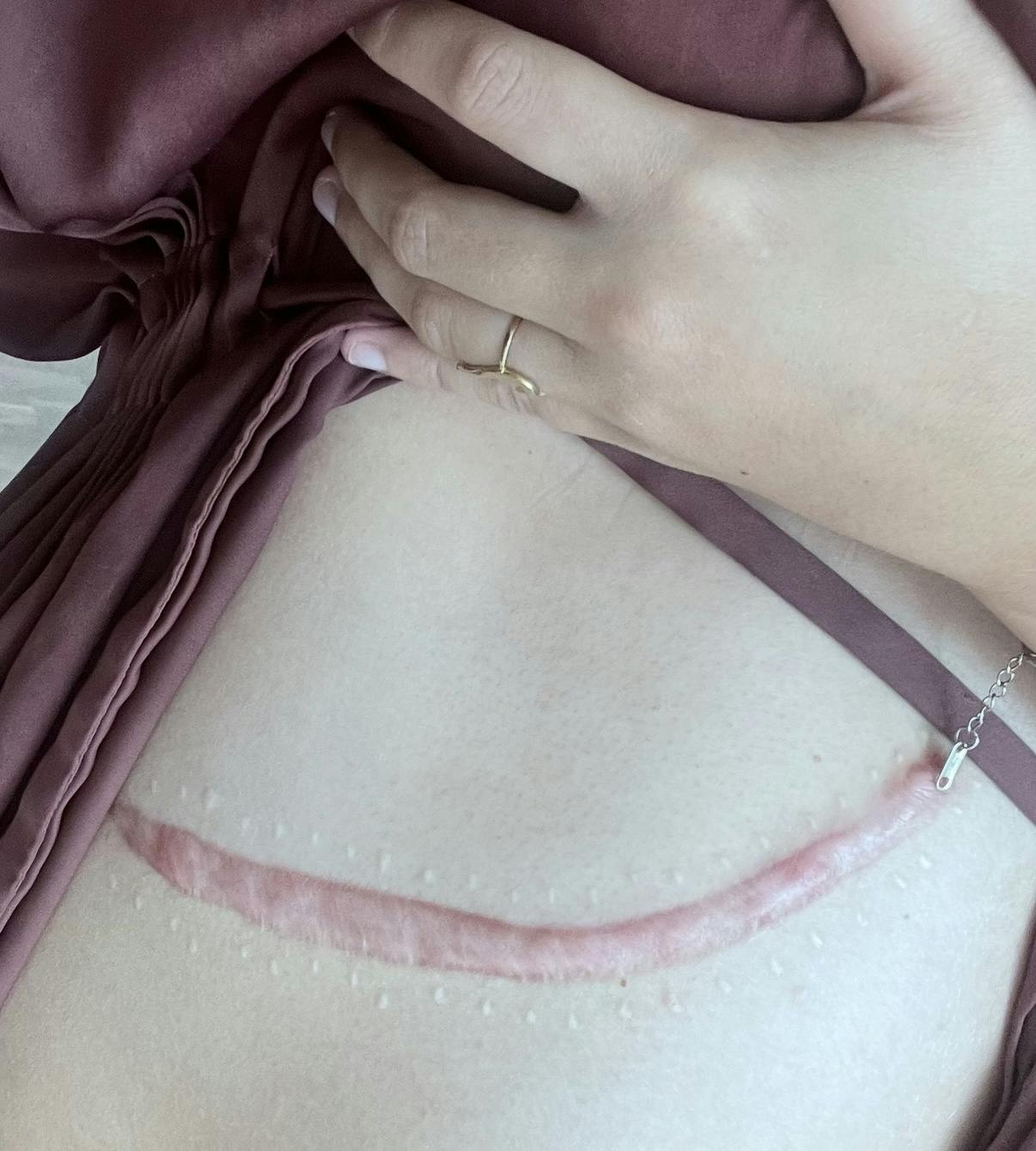 Amalie var i flere måneder bange for, at hun havde kræft i leveren, derfor kunne hun ånde lettet op, da lægerne fandt en godartet tumor.