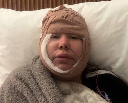 Kailyn Lowry så noget særlig ud efter sin operation.