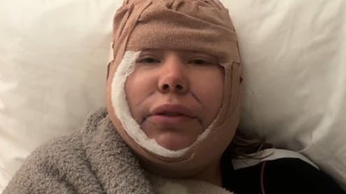 Kailyn Lowry så noget særlig ud efter sin operation.