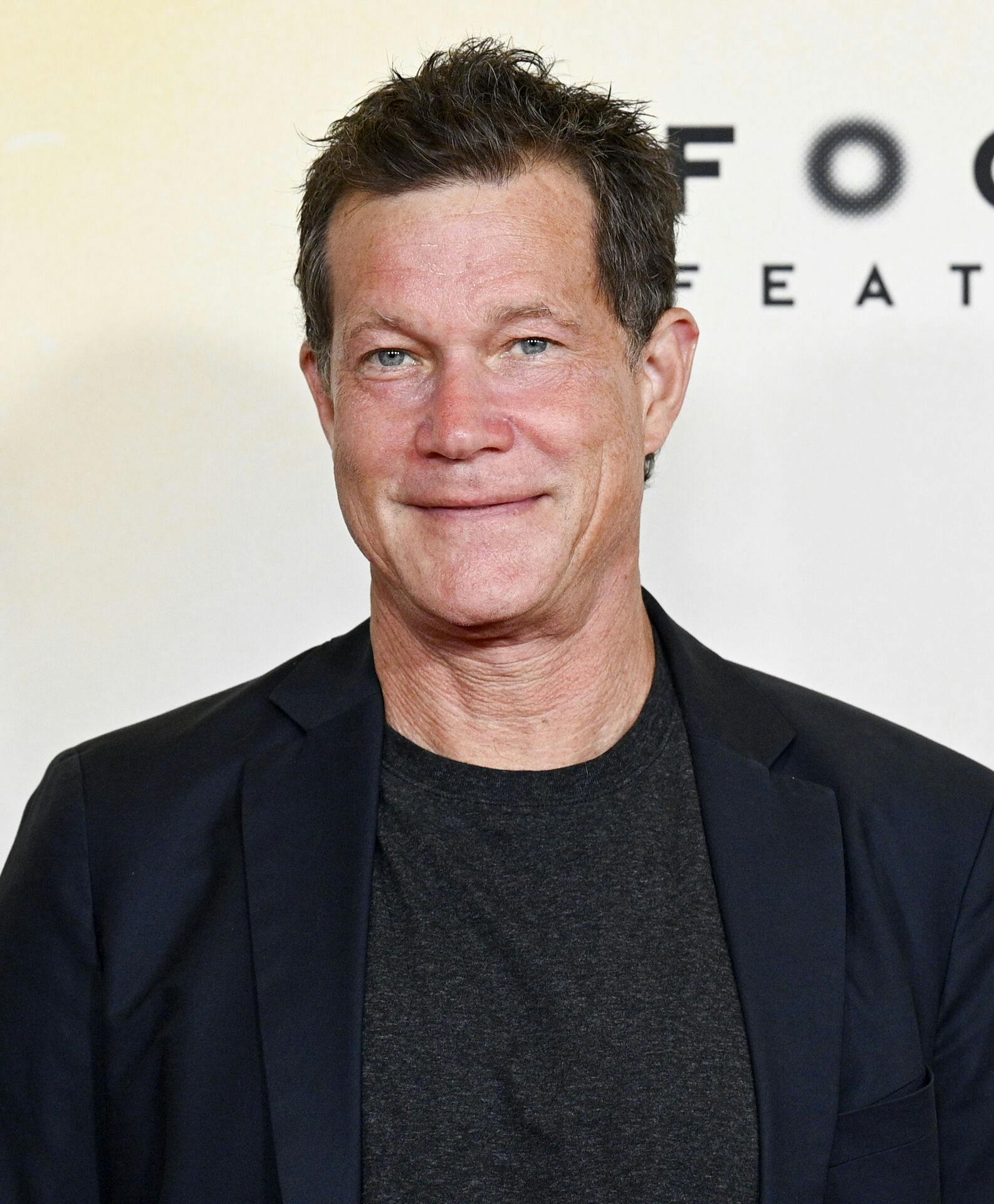 En talsperson fortæller nu, at Dylan Walsh fik en hjerneblødning.