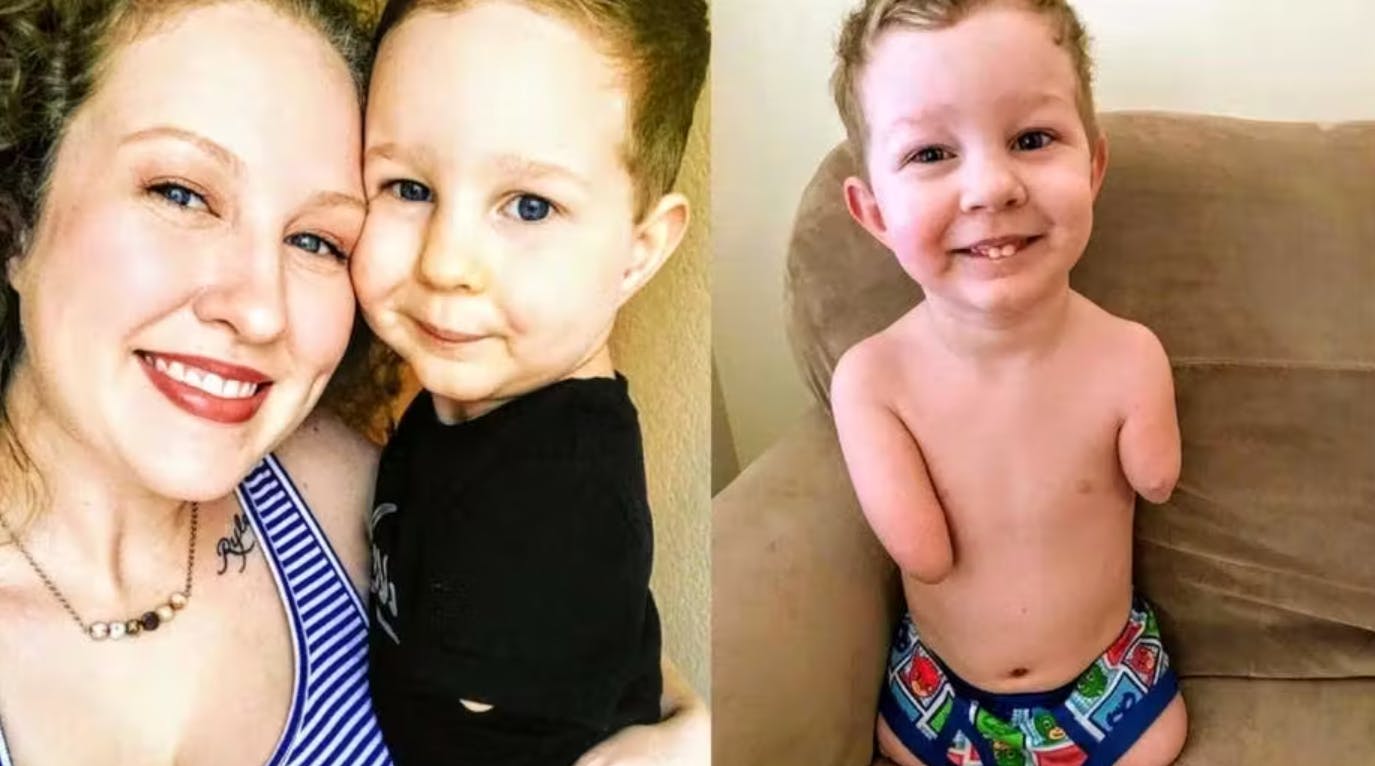 For snart 12 år siden blev amerikanske Katie gravid i en alder af blot 18 år. Da jordemoderen opdagede, at det ufødte barn manglede alle sine lemmer, forlangte Katies voldelige kæreste, at hun fik en abort. Men Katie lyttede i stedet til sit moderhjer