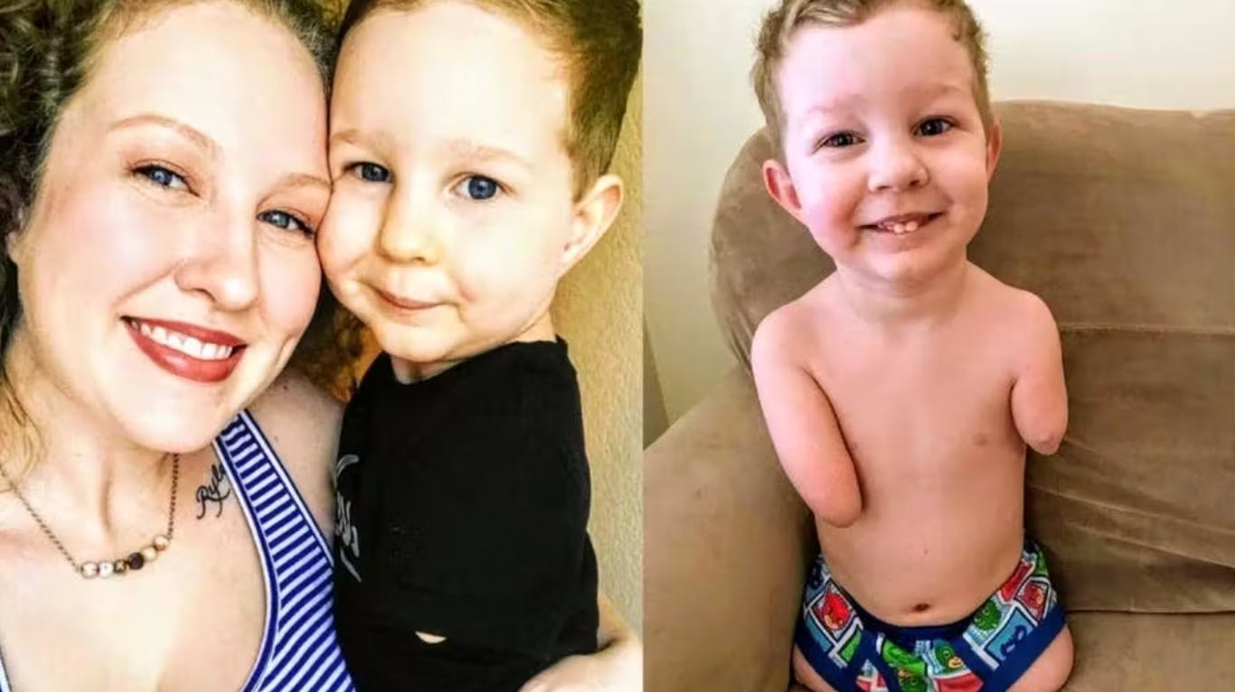 For snart 12 år siden blev amerikanske Katie gravid i en alder af blot 18 år. Da jordemoderen opdagede, at det ufødte barn manglede alle sine lemmer, forlangte Katies voldelige kæreste, at hun fik en abort. Men Katie lyttede i stedet til sit moderhjer