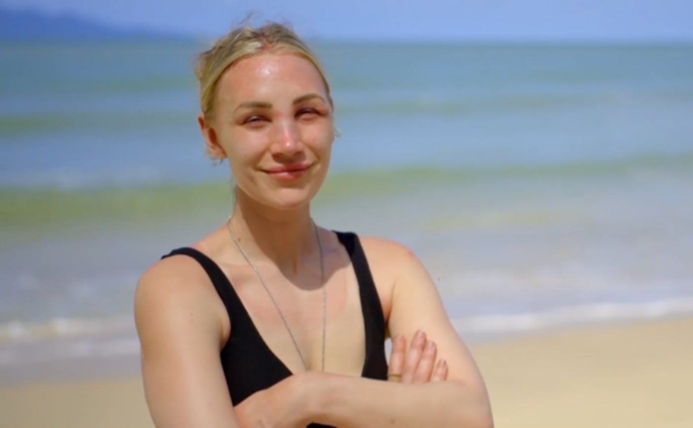 Kira Smed blev hårdt ramt af solen, så snart hun ramte det malaysiske sand i "Robinson Ekspeditionen".