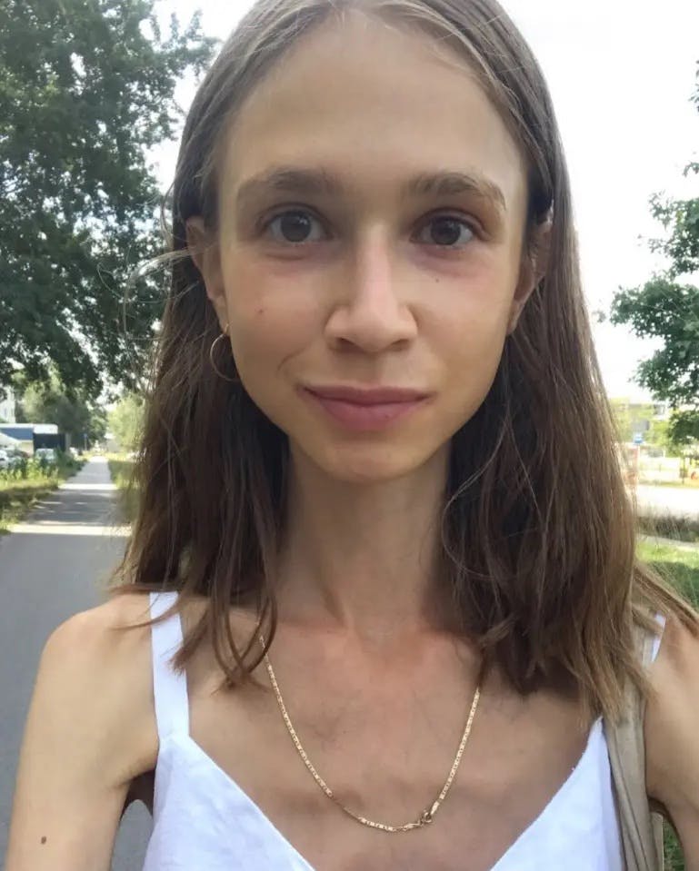 27-årige Karolina Krzyzak,  blev sidste år fundet død på et hotelværelse på Bali – forinden havde den unge kvinde i alt for mange år levet af frisk frugt og intet andet