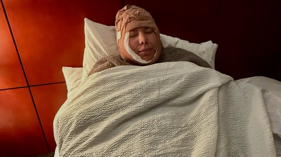 "Teen Mom"-stjernen har både fået et ansigtsløft og fjernet mavefedt.