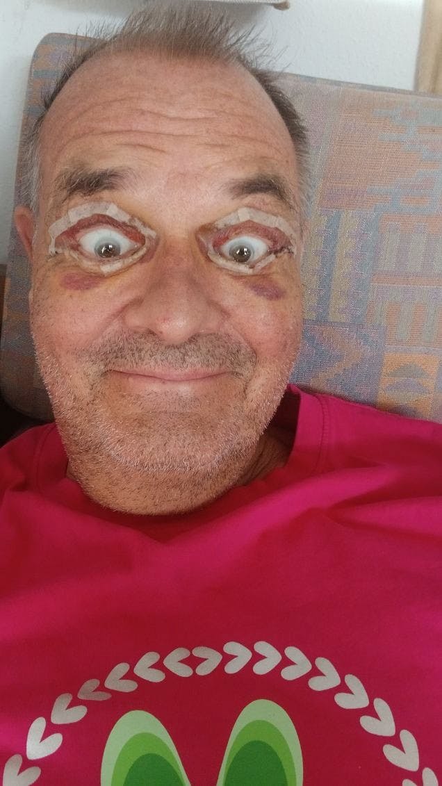 Ole har været svimmel, men har ellers haft det godt.