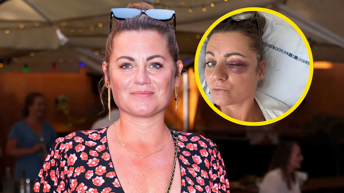 Halvt år efter kraniebrud: Karen-Helene Hjorth vender tilbage til TV 2 | SE og HØR
