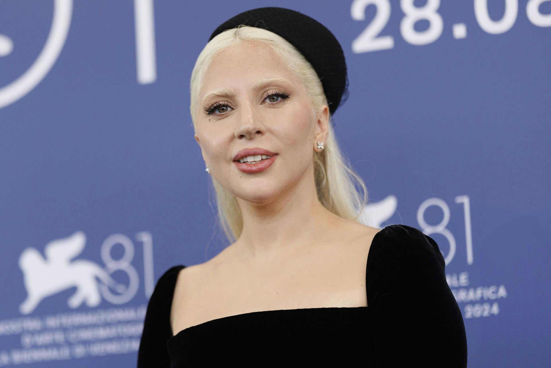 Lady Gaga afslører nu, at hun var stærkt medicineret under optagelserne til "A Star Is Born".