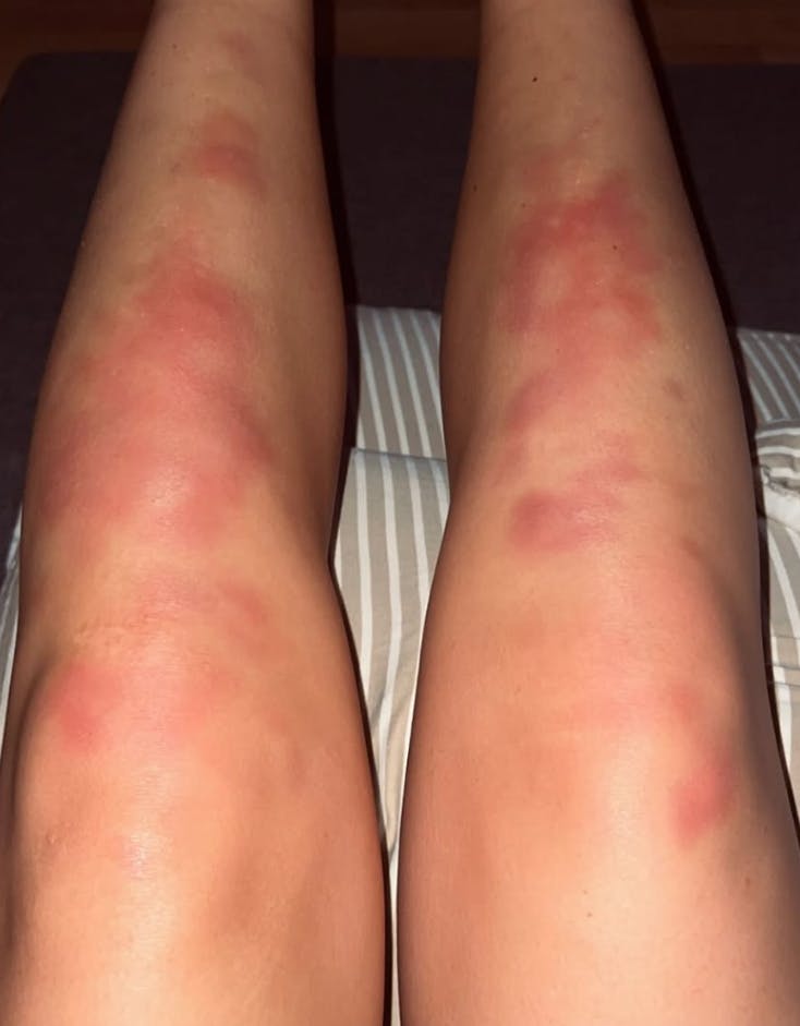 Der har været mange op- og nedture i hendes forløb.