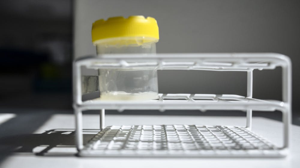 Dansk donorsæd med alvorlig genmutation er blevet solgt til 67 klinikker i 14 forskellige lande, skriver DR. (Arkivfoto).