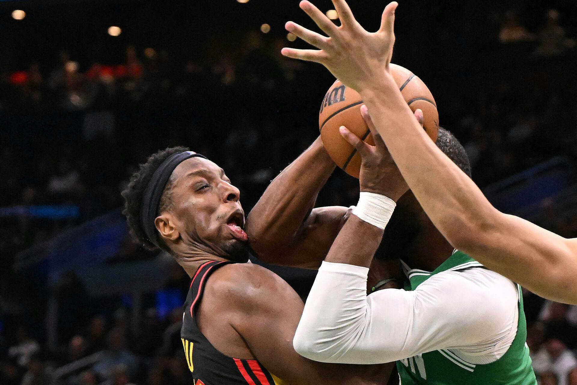 Jan 28, 2026; Boston, Massachusetts, USA; Atlanta Hawks forward Onyeka Okongwu (17) reacts after being hit in the jaw with an elbow by Boston Celtics guard Jaylen Brown (7) during the second half at the TD Garden. Mandatory Credit: Brian Fluharty-Imagn Images