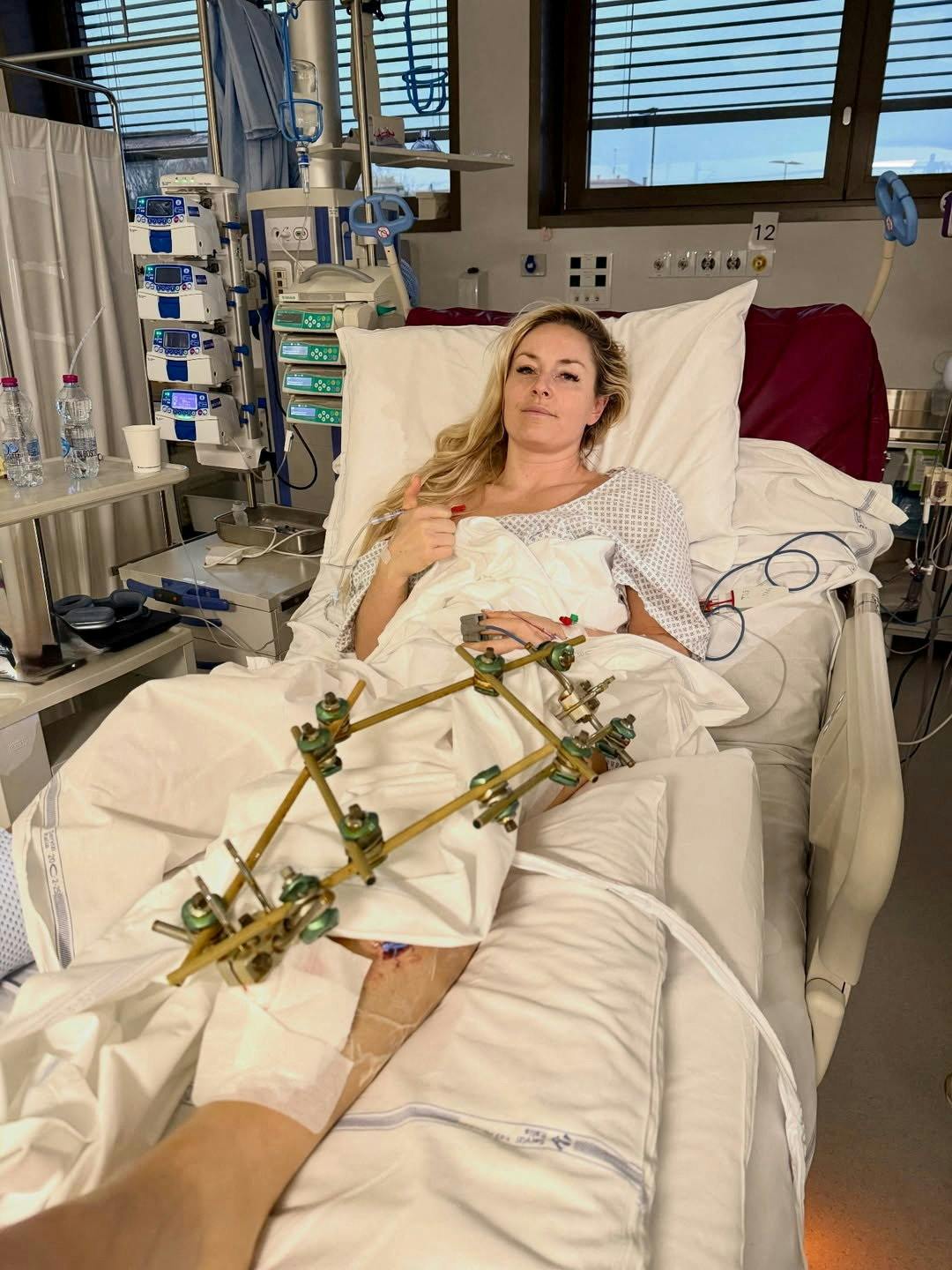 Lindsey Vonn er ved godt mod efter det forfærdelige styrt. Onsdag gennemgik hun den tredje operation.