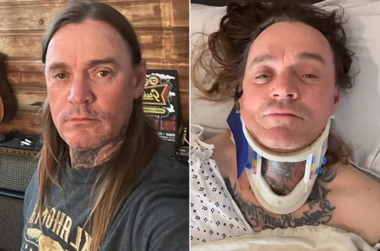 Countrystjernen er indlagt på hospitalet efter en uhyggelig ulykke.