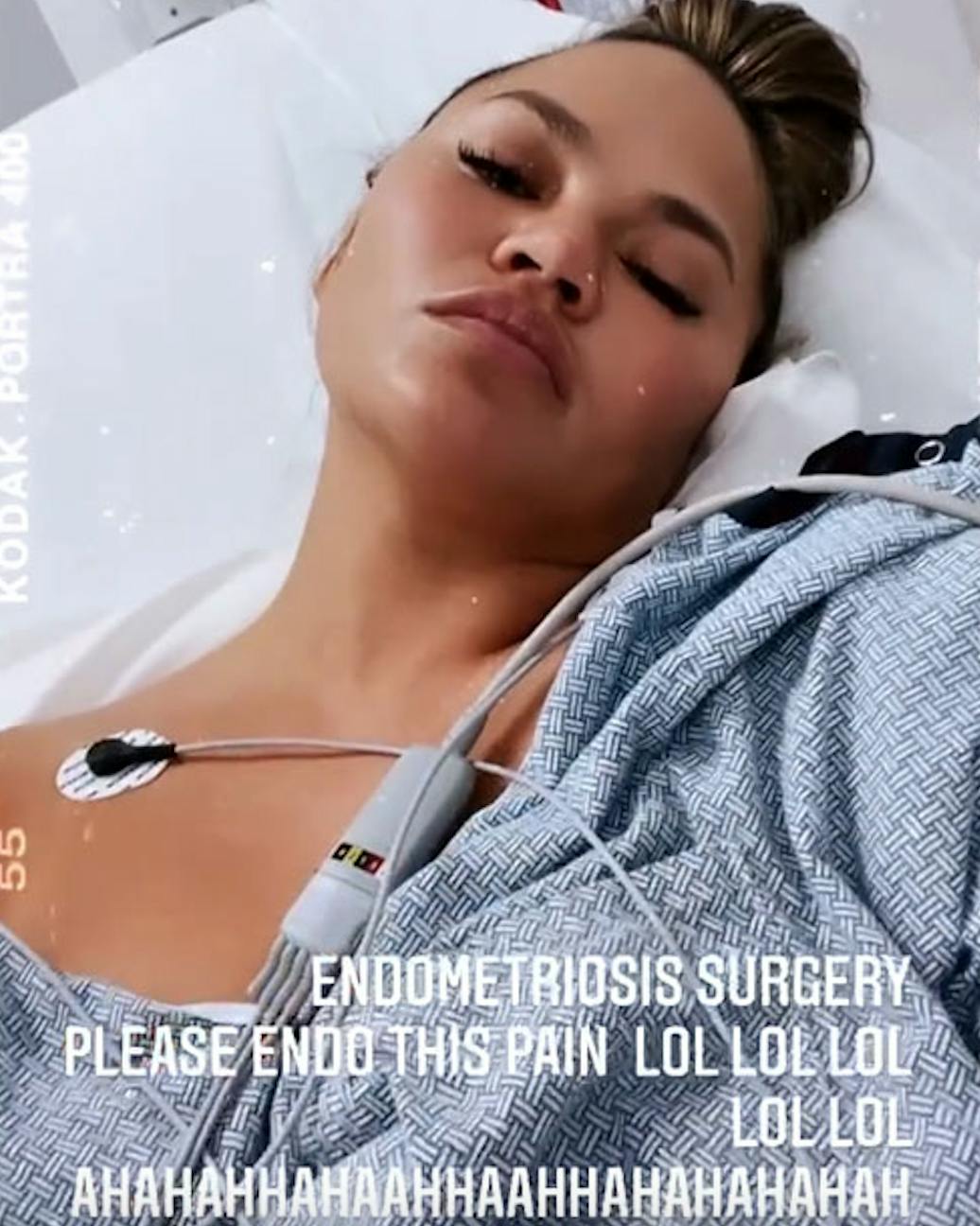 https://imgix.seoghoer.dk/chrissy-teigen_0.png