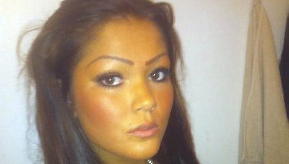 Denise fik et allergisk anfald og måtte på hospitalet