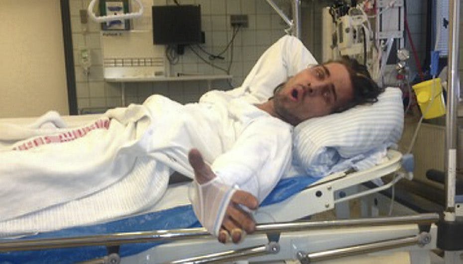 Selv om det ser alvorligt ud, så slap Mikkel Serwin "billigt" fra den alvorlige ulykke.